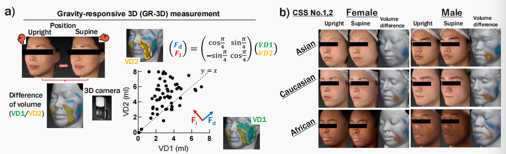 CIRS功效评价,技术实践,下垂,水肿,定量评估