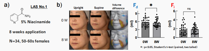 CIRS功效评价,技术实践,下垂,水肿,定量评估