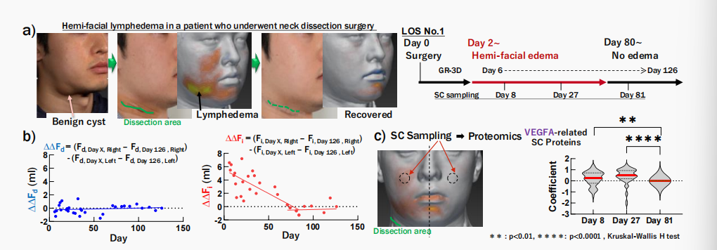 CIRS功效评价,技术实践,下垂,水肿,定量评估